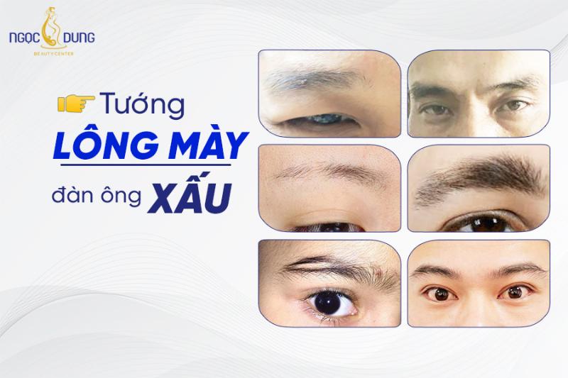 Lông mày đàn ông xấu trong cuộc sống